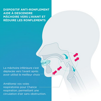 Elastyczna i dopasowująca się orteza przeciw chrapaniu i bezdechowi sennemu