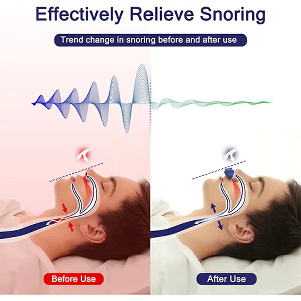 Elektryczne urządzenie powstrzymujące chrapanie zapobiega chrapaniu i chrapaniu