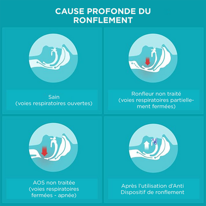 Elastyczna i dopasowująca się orteza przeciw chrapaniu i bezdechowi sennemu