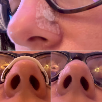 Ekspander oddechu zatrzymujący chrapanie Urządzenie przeciw chrapaniu